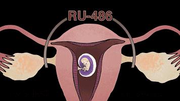 多次打胎真实案例,25岁女生接受多少次打胎