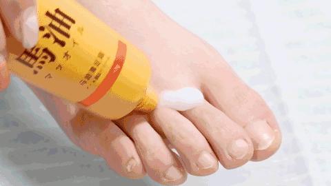 治疗脚气烂脚丫的小妙招,如何治疗脚臭脚气脚后跟开裂