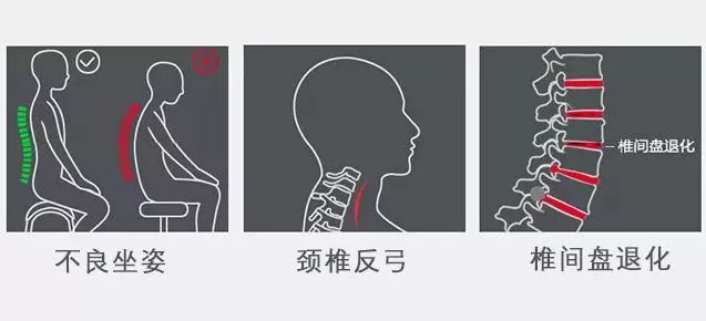 日本护颈神器有用吗视频,护颈最好的神器