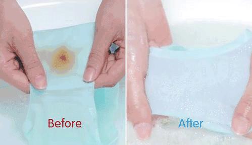 瘙痒难忍、有异味、反复发作，是你这里出了问题！