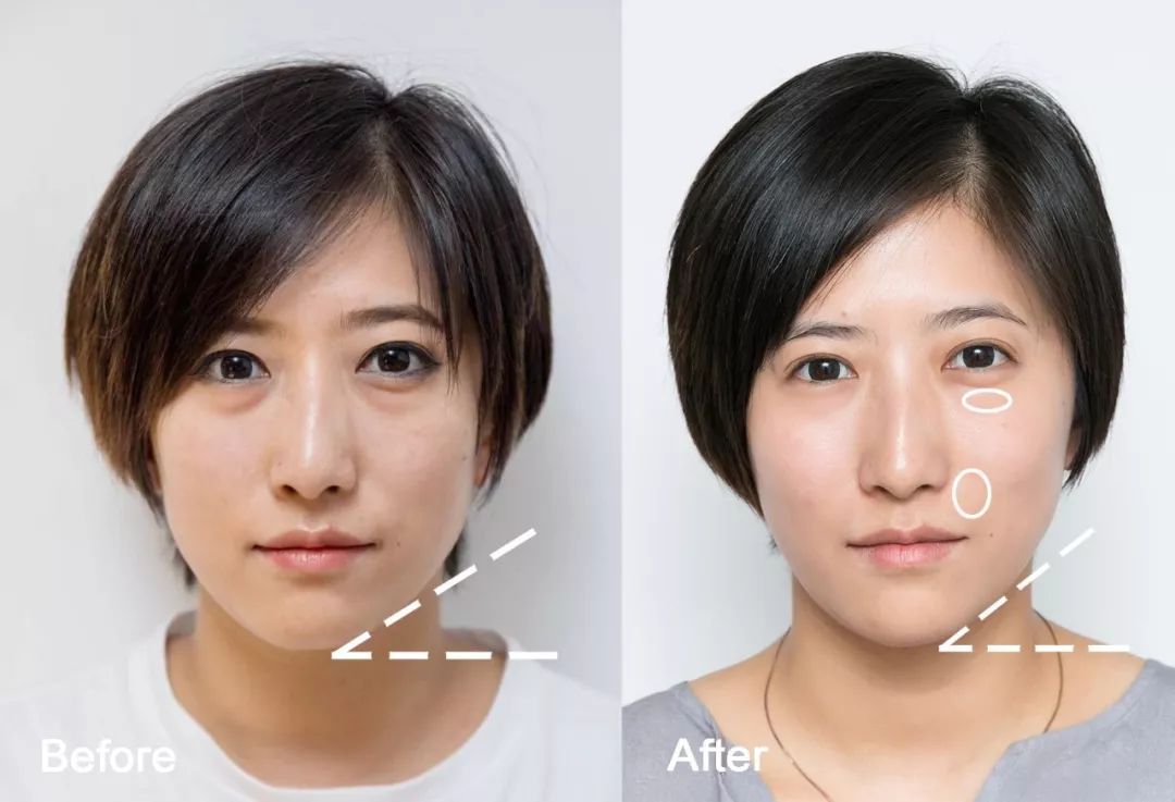 灏忚寕鑲岃瘖瀹ゅ埌搴曟湁澶氬己,灏忚寕鑲岃瘖瀹よˉ姘村悧