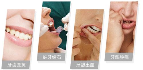 想让牙齿健康用什么牙膏,想让牙齿变健康该吃点什么