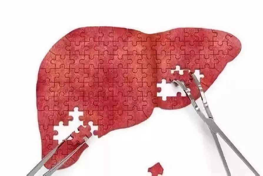 抗病毒治疗转氨酶反而升高,他汀引起的转氨酶升高怎么治疗