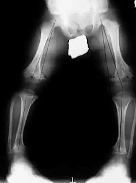 o型腿瑜伽视频,o型腿最快变直的瑜伽