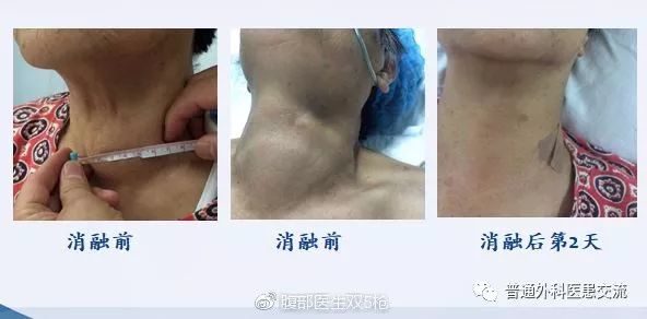 不懂的医生能从ct看出舟状头吗,看不明白甲状腺报告单