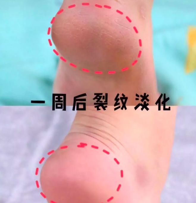 spa绮炬补缇庡鎵嬪,绮炬补spa鎵嬮儴