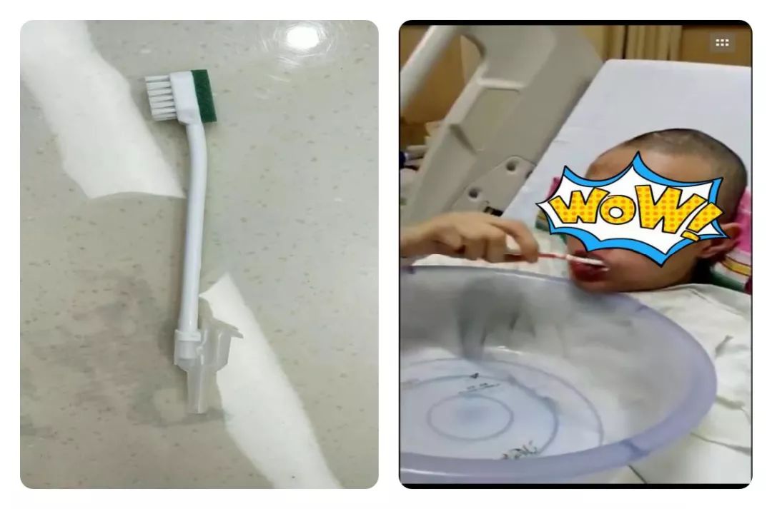 了解吞咽障碍的症状和预防措施,吞咽障碍的相关知识