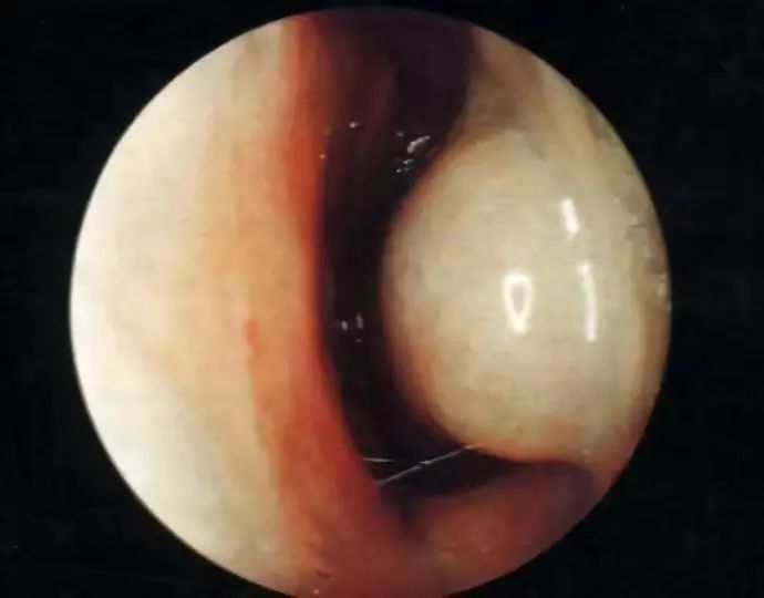中医帮扶指导具体措施,董氏针灸治疗过敏性鼻炎的特效