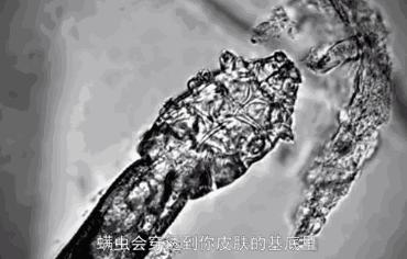 头皮除螨虫神器哪种好用,头皮除螨推荐控油产品吗