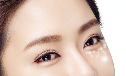 千万别把眼袋当卧蚕,倪海厦中医讲堂说眼袋