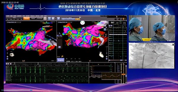 「房颤专项能力培训第11期」北京协和医院站:直面临床难点,内容丰富而实用!