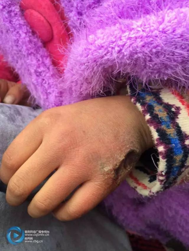 红樱桃志愿服务捐赠,重庆红樱桃志愿行动