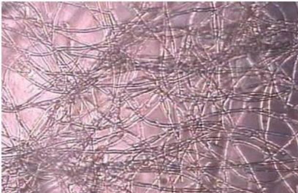 被污染的细胞,污染的细胞怎么处理