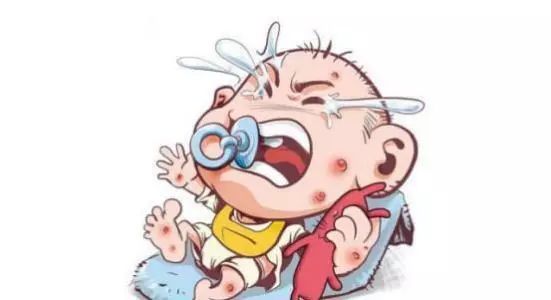 水痘高发期来临时刻准备战痘,水痘高发期请做好战痘准备