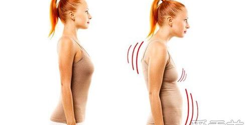 驼背晚上正确的睡姿,驼背晚上睡姿矫正图解图片