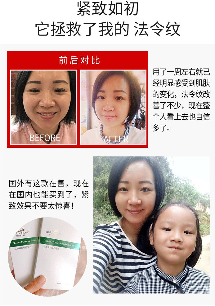 你的法令纹怎么去,你的法令纹越来越浅