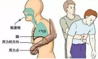 五岁男孩误食硬币想呕怎么办,男童误食硬币