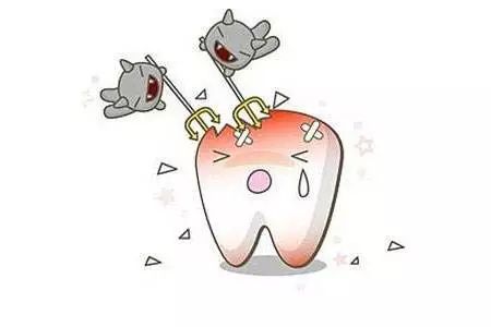 牙齿楔状缺损怎么修复,牙齿龋坏小知识