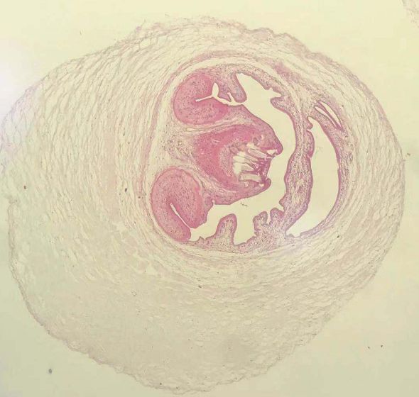 胳膊小臂上突然鼓了一个软包,儿童手臂有个硬硬的鼓包会移动