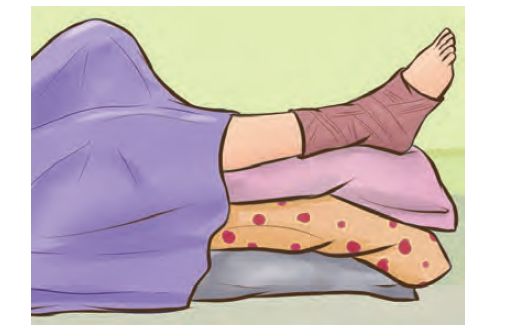 跑步崴脚怎么康复训练图片,跑步崴脚了怎么在家锻炼