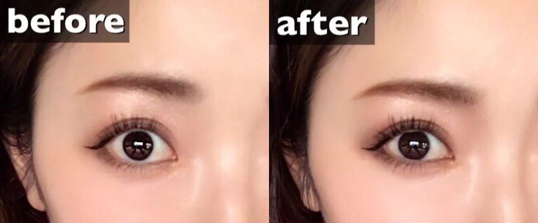 怎么样才能增加眉眼间距,眉眼距怎么通过锻炼改善