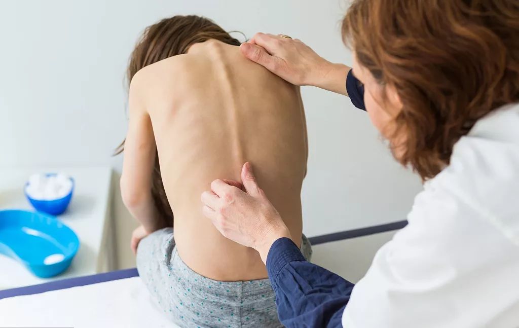 得了脊柱侧弯？你应该这样解决