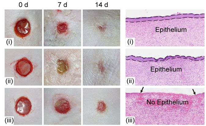 水泥堵鼻子创可贴,创可贴可常贴吗