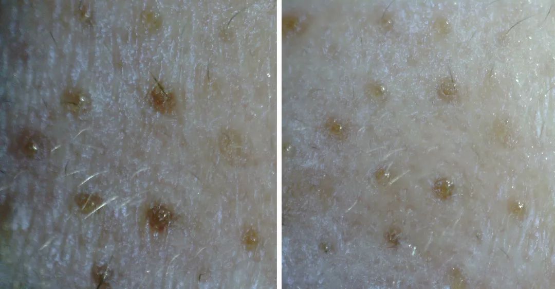 毛孔粗大清洁测评,暗沉粗糙毛孔粗大测评