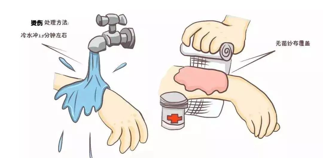 春节时如果被爆竹炸伤该如何急救,过年放鞭炮炸伤怎么处理