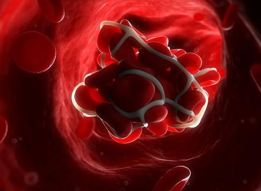 血液里脂肪颗粒多怎么办,脂肪多了会影响血液么