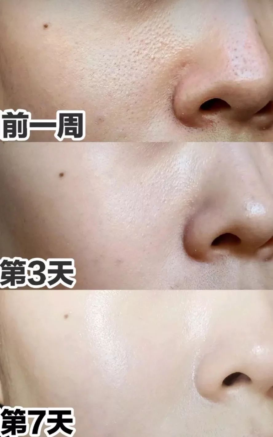 火山泥膜深层清洁面膜测评,嫩肤的白泥面膜评测