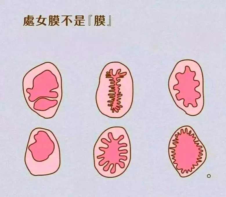 「女科荟」大部分人都错了——处女膜其实不是膜！
