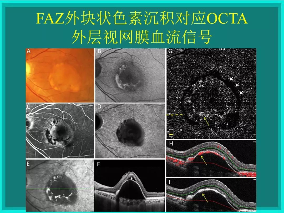明者远见于未萌原文,明者远见于未萌解释