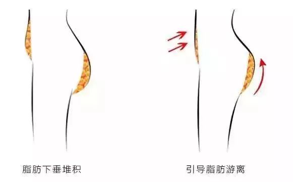 80岁妇科病与内裤有关系吗,80%的妇科问题