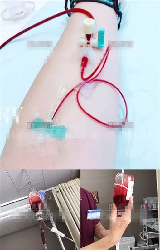 美容又“防癌”？女子竟然在体外“洗血”，这种医美太可怕……