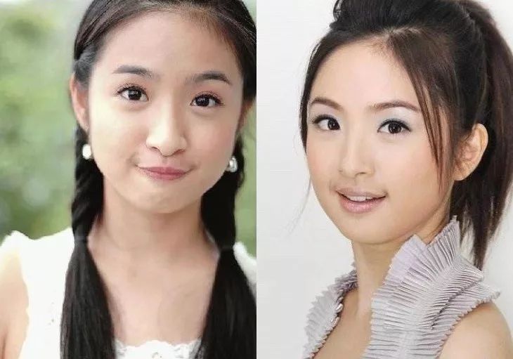 猕猴桃女孩一定要脱毛吗,夏天的猕猴桃