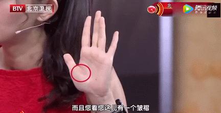 手上的青筋突然暴起代表什么意思,孩子吓到了手上有青筋是怎么回事