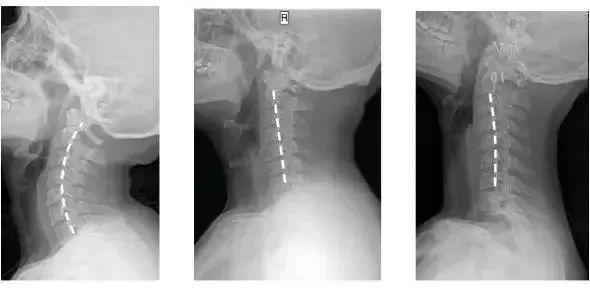 拯救你的颈椎!这款德国变态”护颈”神器,让你坐着比躺着还舒服,连失眠也能救一下