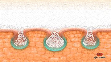 祛斑美白补水祛皱祛痘,祛斑祛痘美白改善暗沉