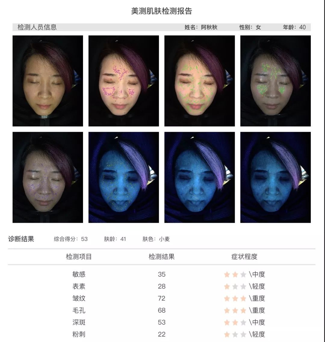 小茂肌诊室到底有多强,小茂肌诊室皮肤状态