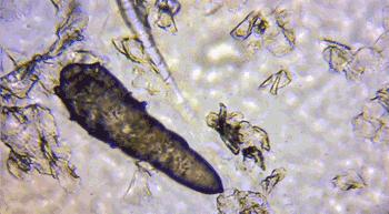 鼻尖挤出白色的是什么,鼻子上挤出的白丝怎么解决