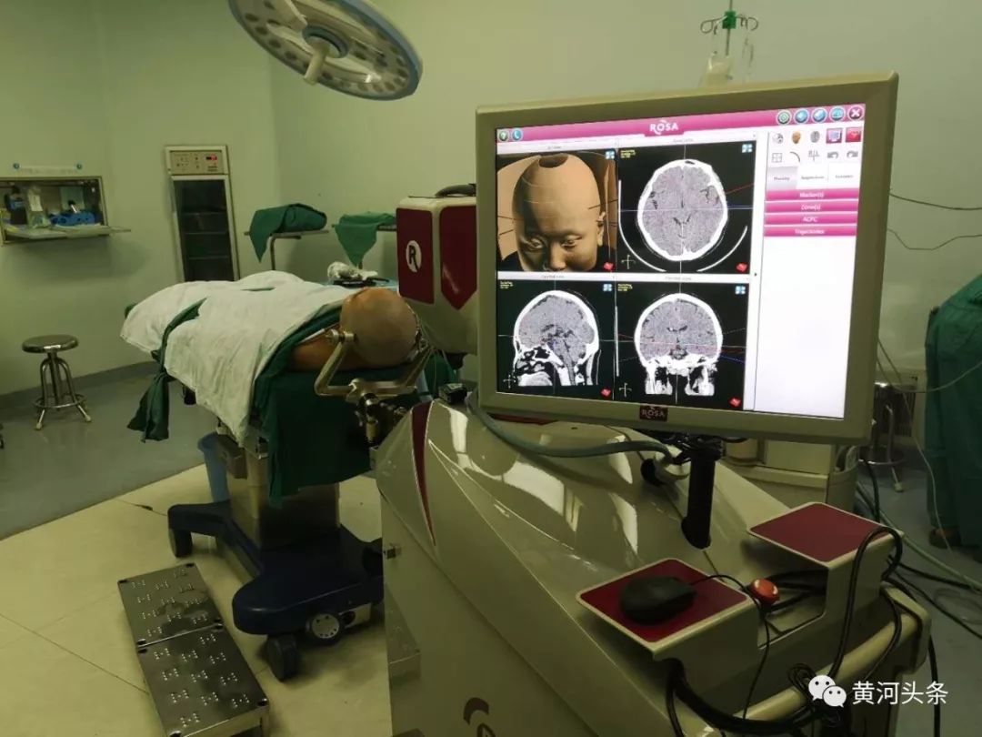 癫痫大脑异常放电会导致头痛吗,癫痫患者脑部异常放电有意识