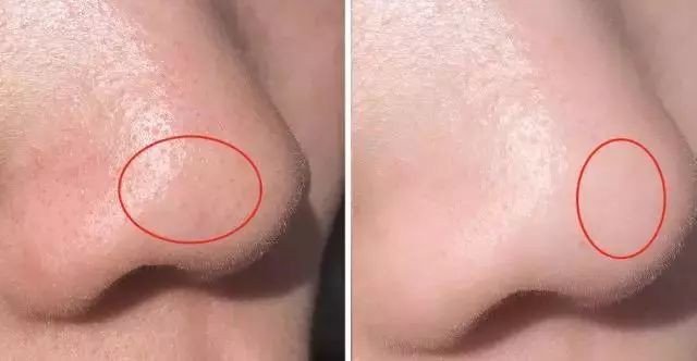 用了几年的火山泥一洗白,用火山泥洗澡