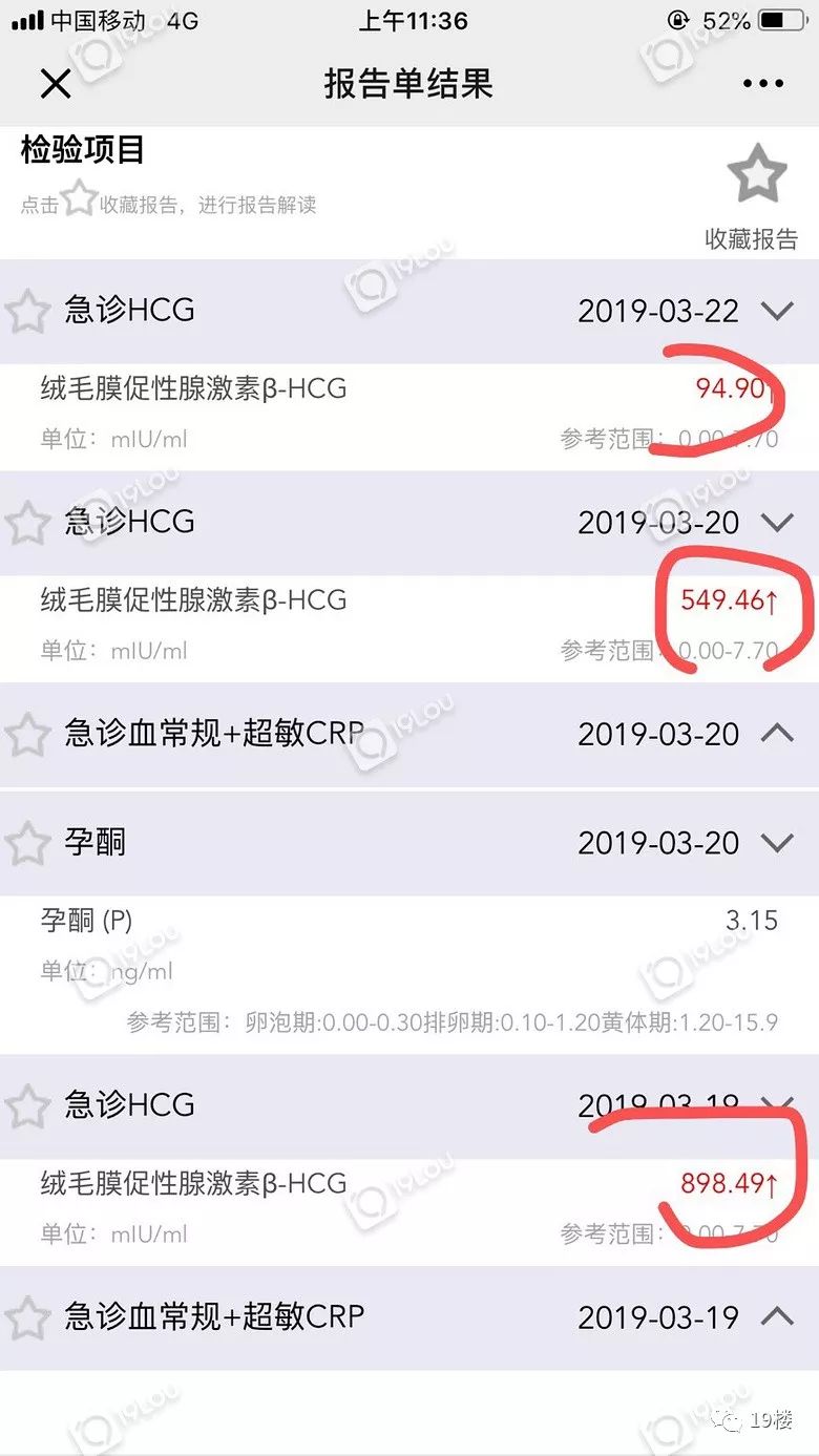 做阴超流产了,做完阴超自然流产
