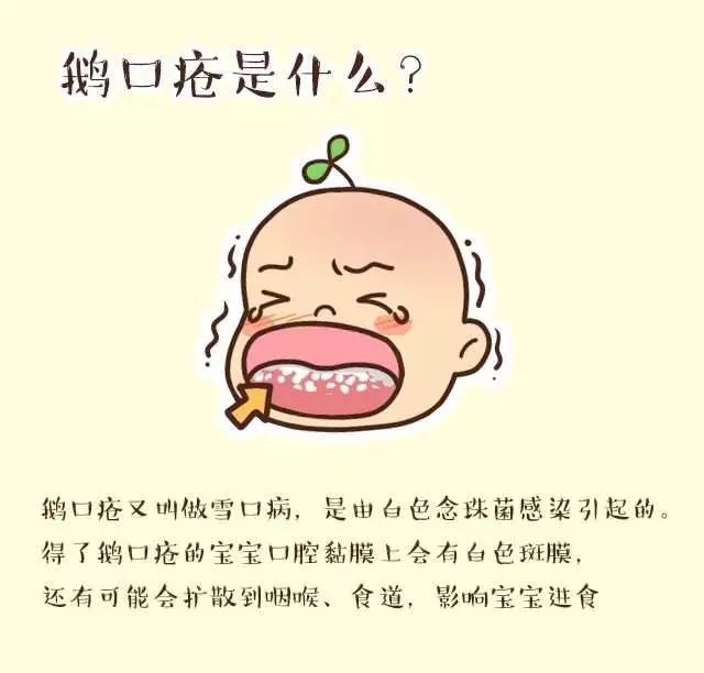 小儿鹅口疮的科普知识,怎么辨别宝宝得了鹅口疮
