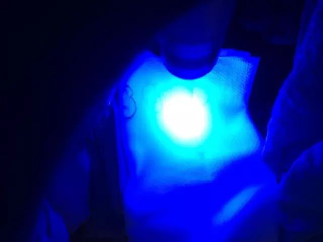 9岁孩子误吞塑料笔帽,小孩气管被圆珠笔帽卡住了