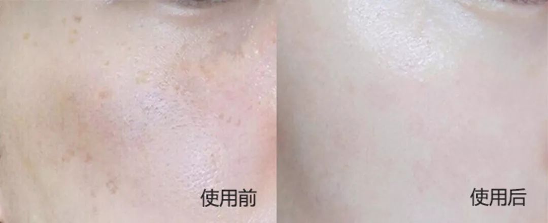 媲美大牌的平价面霜，不到一个月让我白了两度，连斑都看不见了！