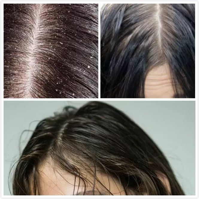 新西兰深度睡眠喷雾,新西兰深睡眠喷雾