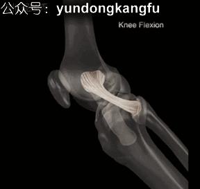 膝腓侧副韧带损伤怎么恢复,膝内侧副韧带损伤修复视频