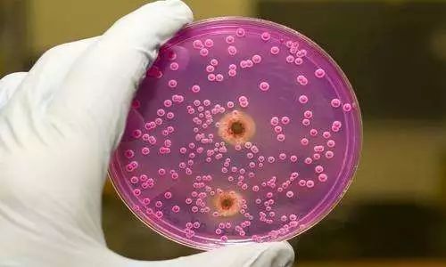 针对这个孕期最烦人的私密问题我们有一种靠谱的新疗法